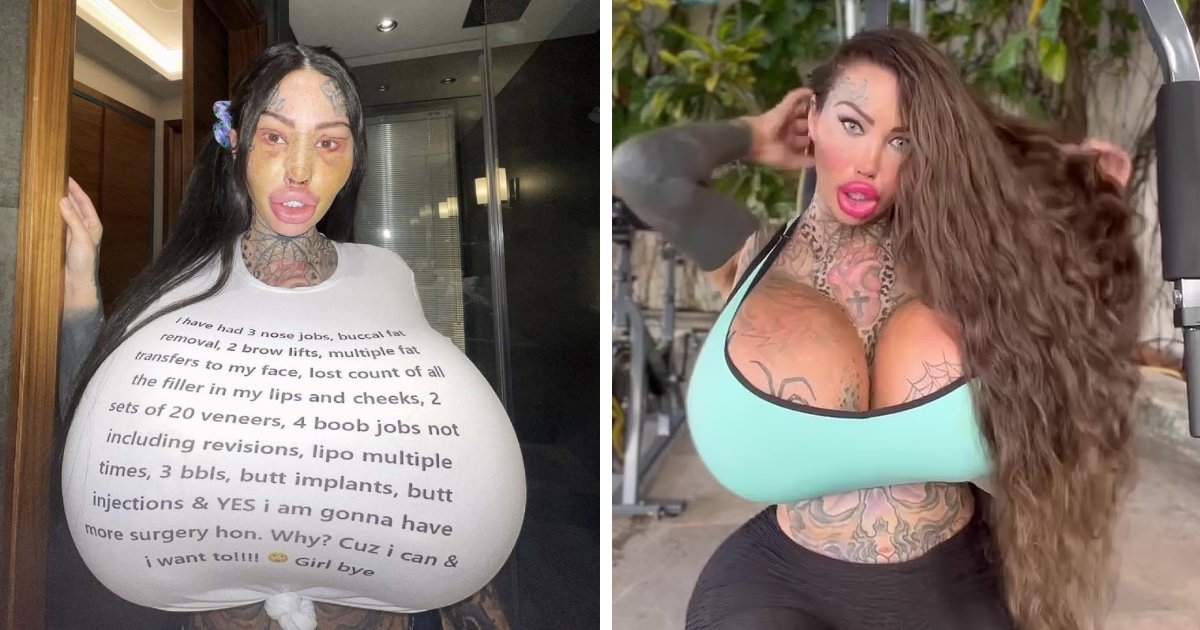 t10 3 1.png?fit=1024%2C538&ssl=1&strip=all - Woman With The World's Fattest V*gina Now Requires A 'Mobility Scooter' As Her Giant Assets Need Support