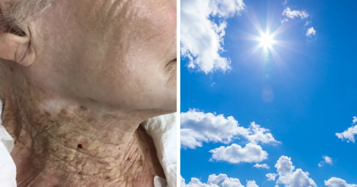 t7 1 1.png?resize=1200,630 - EXCLUSIVE: Startling Image Of 92-Year-Old Woman Who Wore Sunscreen On Her Face & Not Her Neck Stuns Viewers
