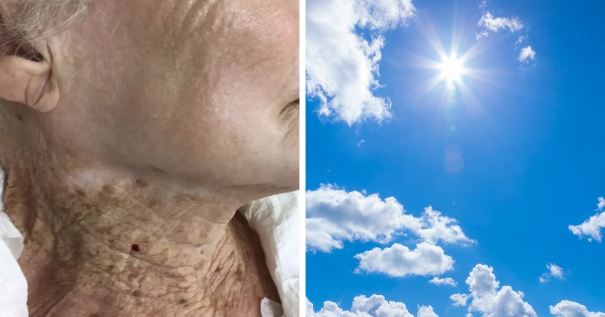 t7 1 1.png?resize=412,275 - EXCLUSIVE: Startling Image Of 92-Year-Old Woman Who Wore Sunscreen On Her Face & Not Her Neck Stuns Viewers