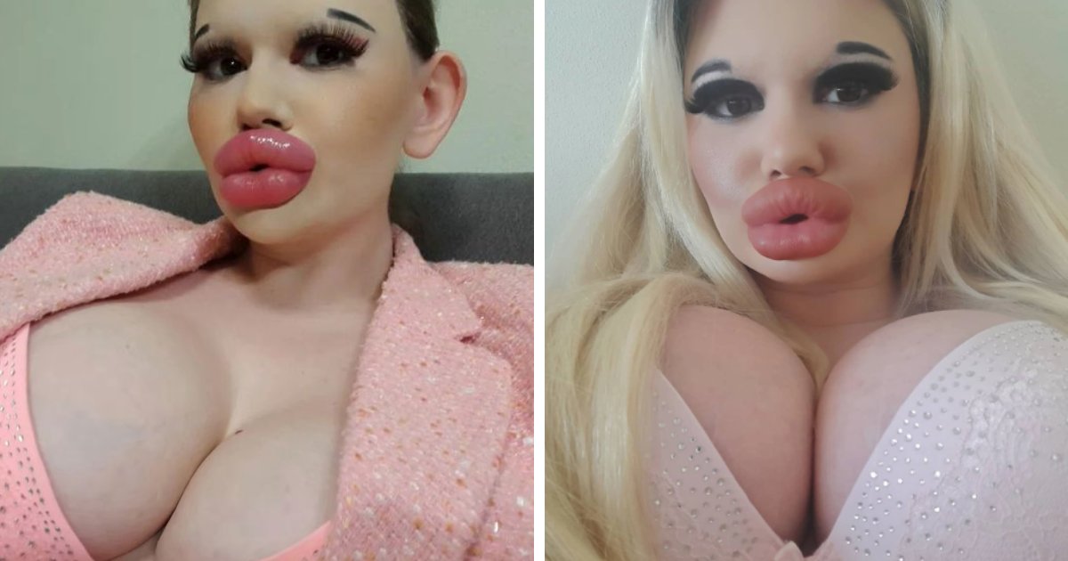 t9 9.png?resize=1200,630 - EXCLUSIVE: Woman With 'Biggest Lips' In The World Says People Are DYING To Fly Her On Holiday