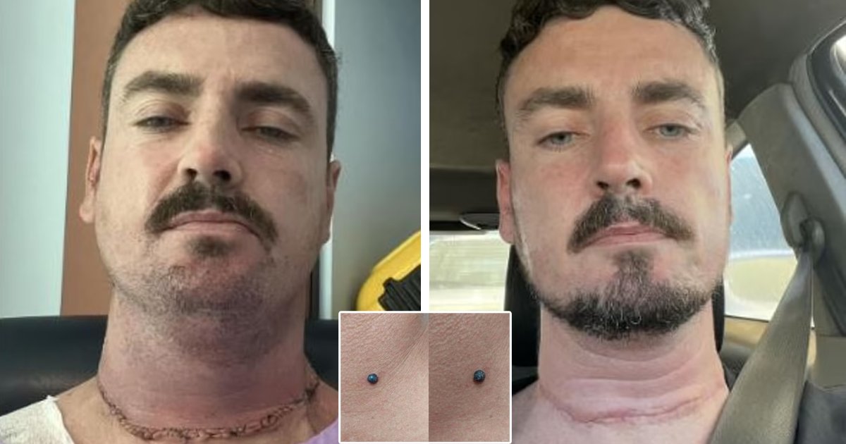 d4.jpeg?resize=412,275 - Man Diagnosed With Terminal Cancer And Given Just Six Months to Live After His Hairdresser Noticed a Mole