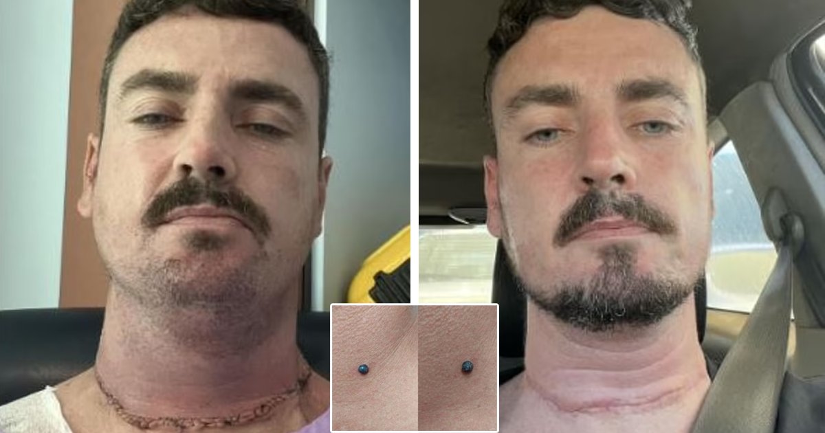 d4.jpeg?fit=1024%2C538&ssl=1&strip=all - Man Diagnosed With Terminal Cancer And Given Just Six Months to Live After His Hairdresser Noticed a Mole