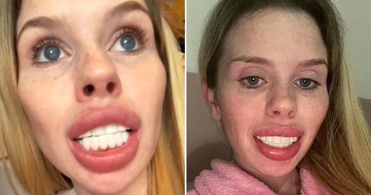 jam4.jpg?resize=412,232 - 23-Year-Old Mom Shows Off Her NEW Veneers But People Are Quick To Comment And Say It Left Her Looking Like A 'Horse'