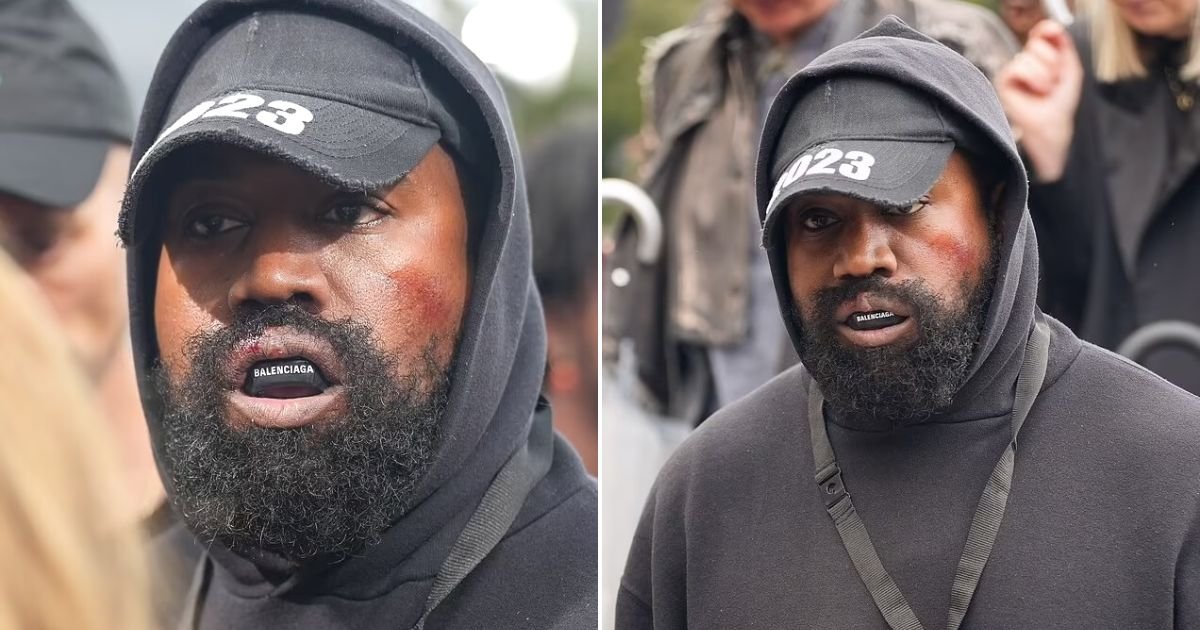 untitled design 90.jpg?fit=1024%2C538&ssl=1&strip=all - JUST IN: Kanye West Seen With A 'Bloodied Face' And A 'Bruised Cheek'