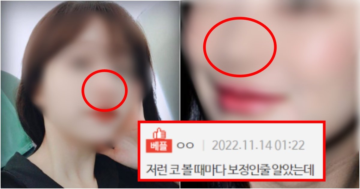 collage 116.jpg?resize=412,275 - ‘저거 더 냅두면 코 안에서 똥냄새남’ 요즘 인플루언서들 코가 이렇게 된 사람이 많은 이유(+사진, 댓글 반응)