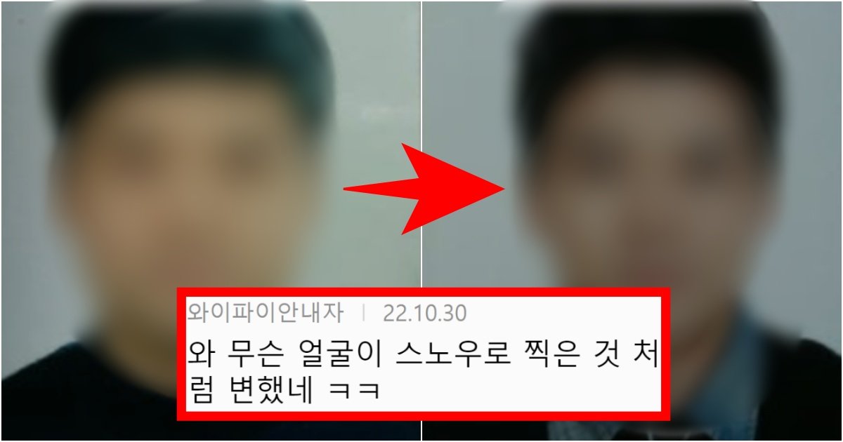 collage 42.jpg?resize=412,275 - ‘은근 할 수 있는 시술 다해ㅋㅋㅋ’ 사실상 연예계 대표 턱 보톡스 홍보 대사 수준(+전 후 사진)