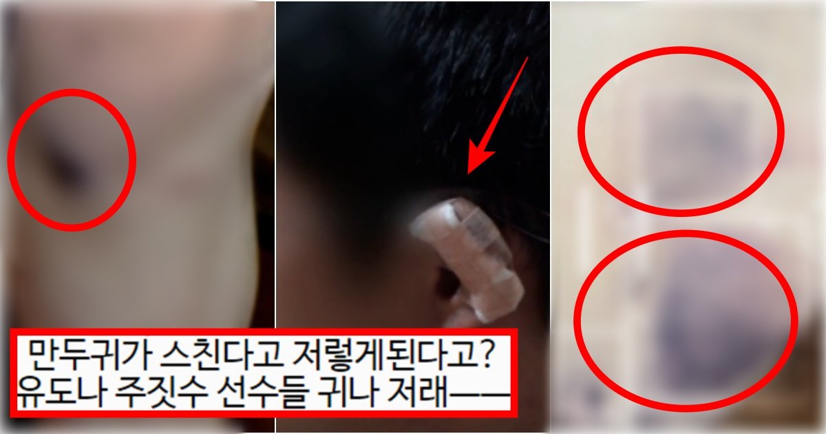 collage 80.jpg?resize=412,275 - ‘만두귀가 스쳐서 생긴건데요?ㅋ’ 어제자 궁금한 이야기y에 방영된 무조건 쌍욕나오는 실제 사건(+증거사진, 진행 중)