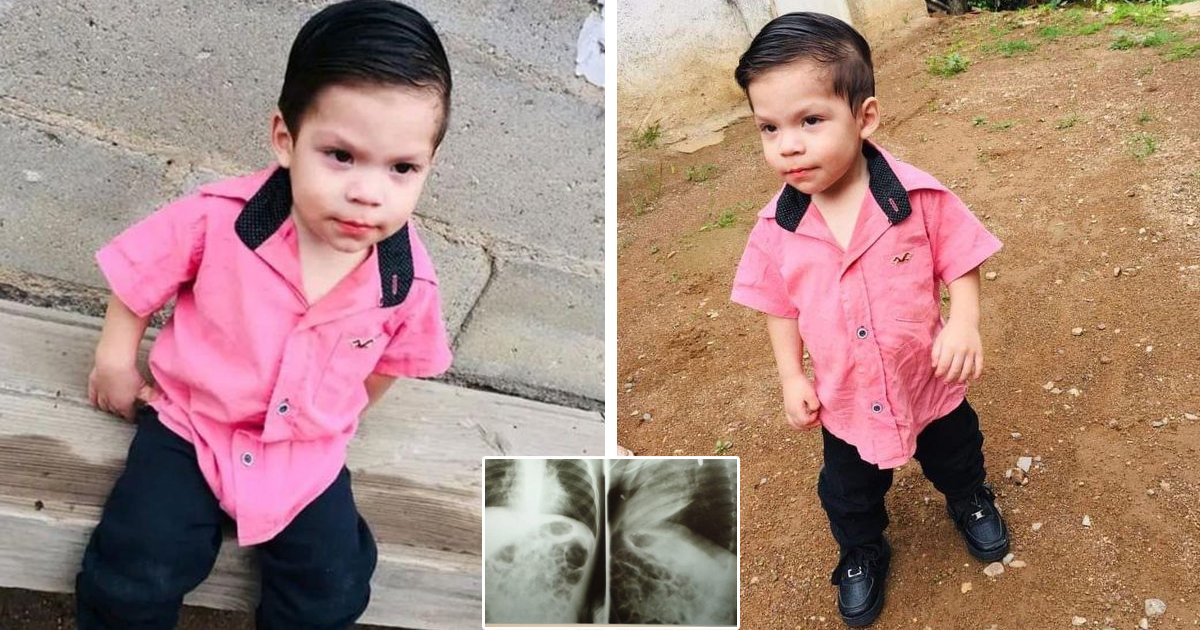 d22 1.jpg?resize=1200,630 - BREAKING: 2-Year-Old Toddler Fights For His Life After SWALLOWING Battery That Explodes Inside Him