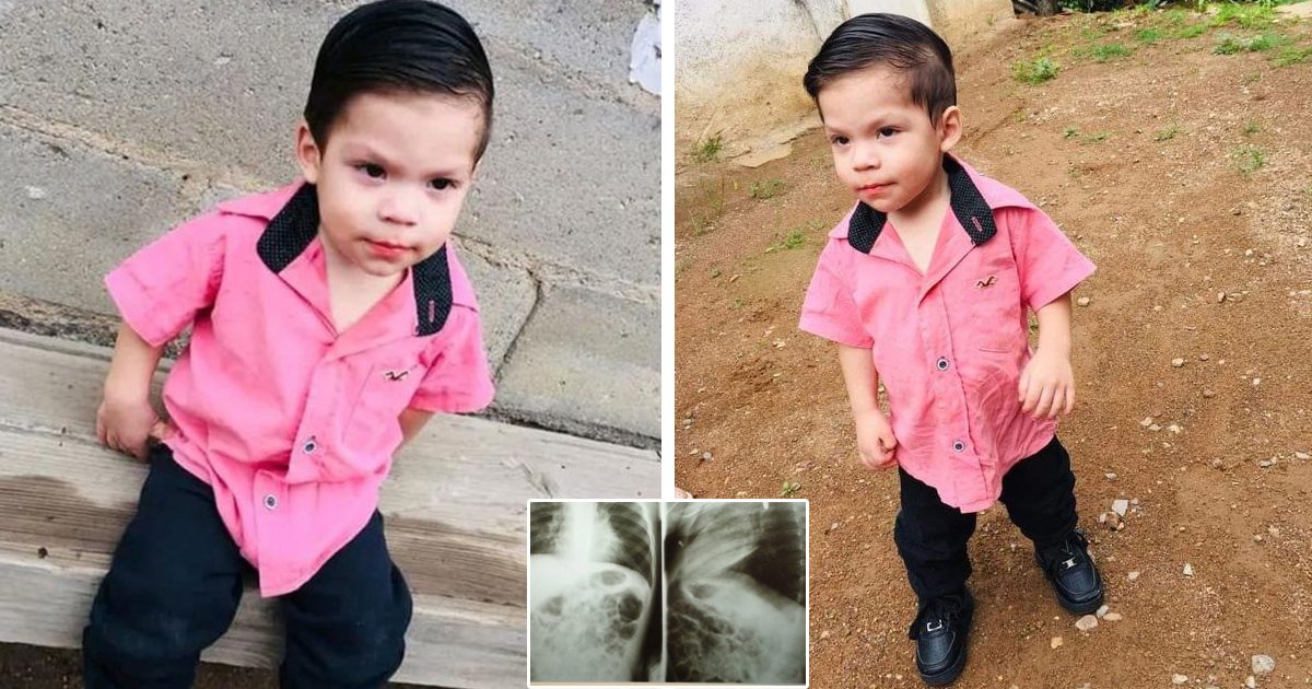 d22 1.jpg?resize=412,275 - BREAKING: 2-Year-Old Toddler Fights For His Life After SWALLOWING Battery That Explodes Inside Him