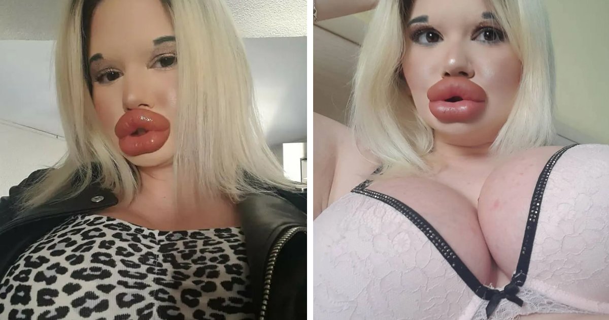 d37.jpg?resize=412,275 - EXCLUSIVE: Woman 'Addicted' To BIG LIPS Says Her Next Injection Could KILL Her But She Is Willing To 'Risk It All'