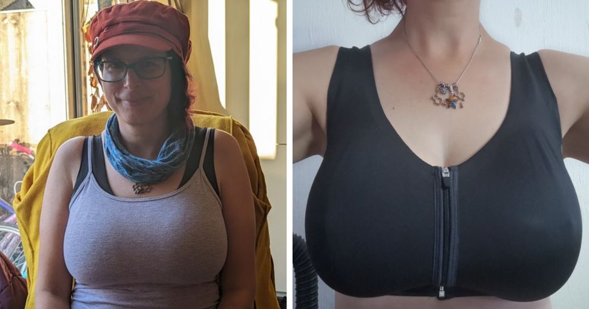 t10 8.png?fit=1024%2C538&ssl=1&strip=all - Woman Heartbroken After Claiming She Was Rejected For Cleavage Reduction Surgery For The Most 'Bizarre' Reason