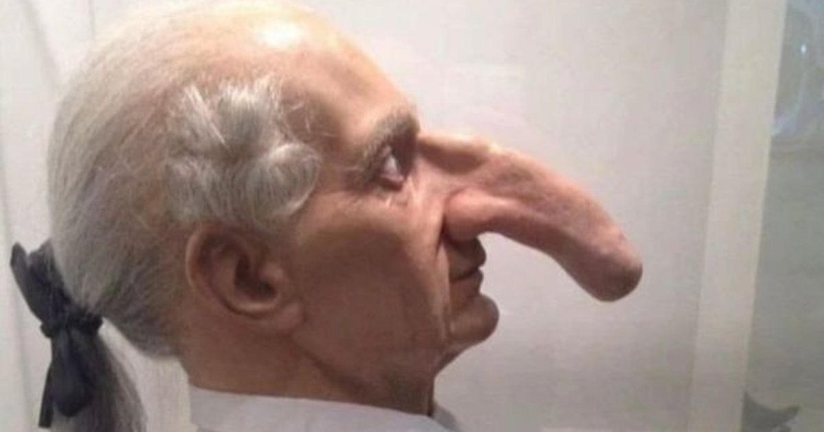 t7 13.png?resize=412,275 - EXCLUSIVE: Man Hailed For Having The 'World's BIGGEST Nose'