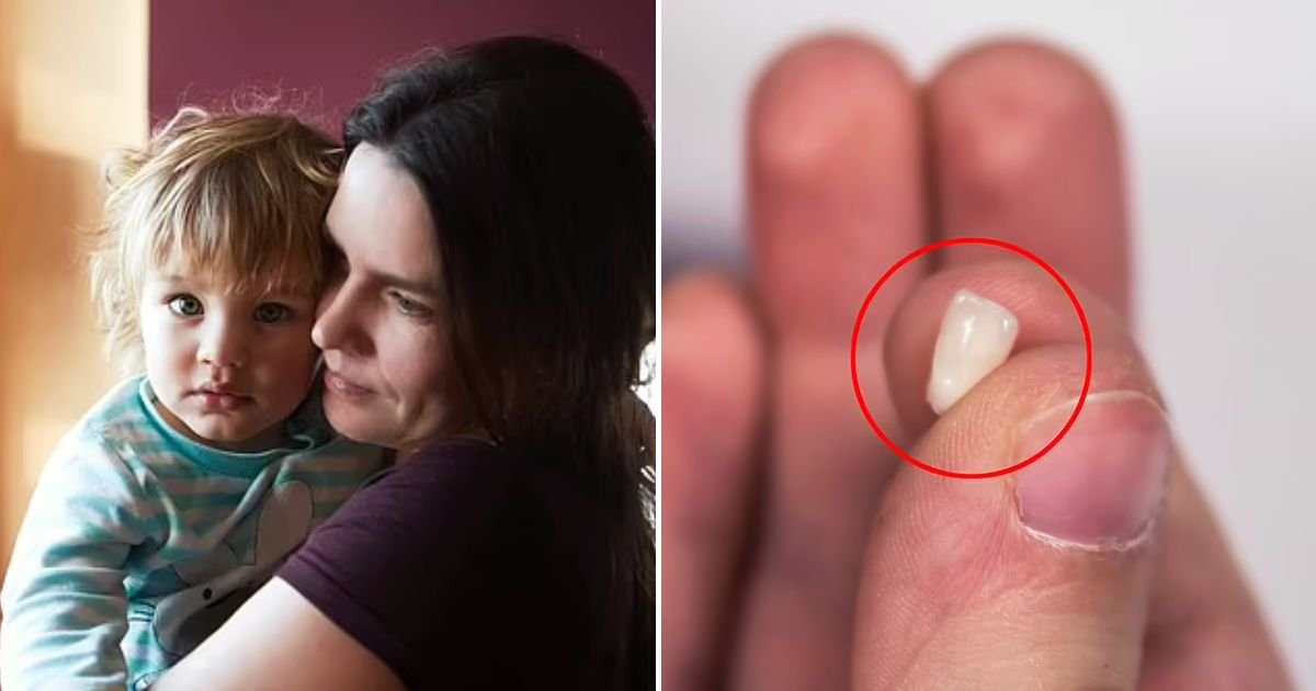 tooth4.jpg?resize=412,232 - Mother FURIOUS After Daycare Teacher Touched Her Daughter's Mouth And Decided To Remove Her Wobbly Tooth