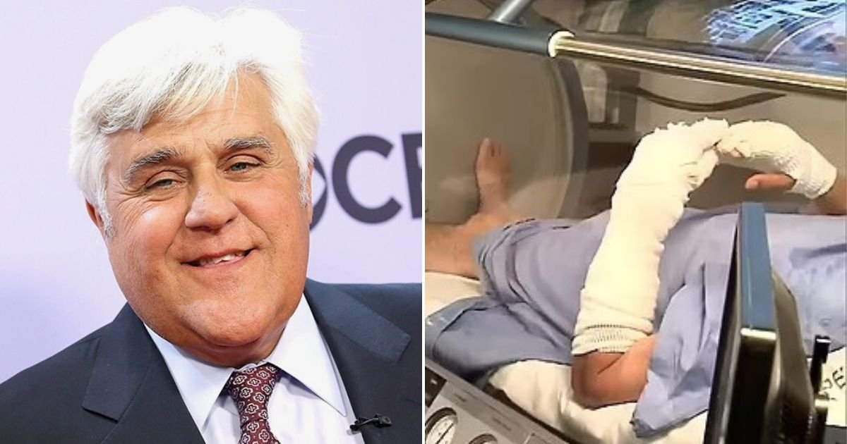 untitled design 73.jpg?resize=1200,630 - JUST IN: Jay Leno's Surgeon Speaks Out And Reveals The Comedian May Suffer PERMANENT Scars As A Result Of His Accident