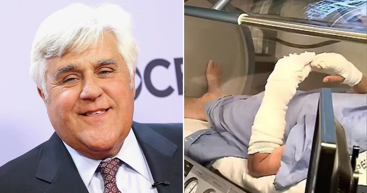 untitled design 73.jpg?fit=1024%2C538&ssl=1&strip=all - JUST IN: Jay Leno's Surgeon Speaks Out And Reveals The Comedian May Suffer PERMANENT Scars As A Result Of His Accident