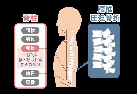 腰椎圧迫骨折の原因・症状・治療法などについて解説 | フランスベッド