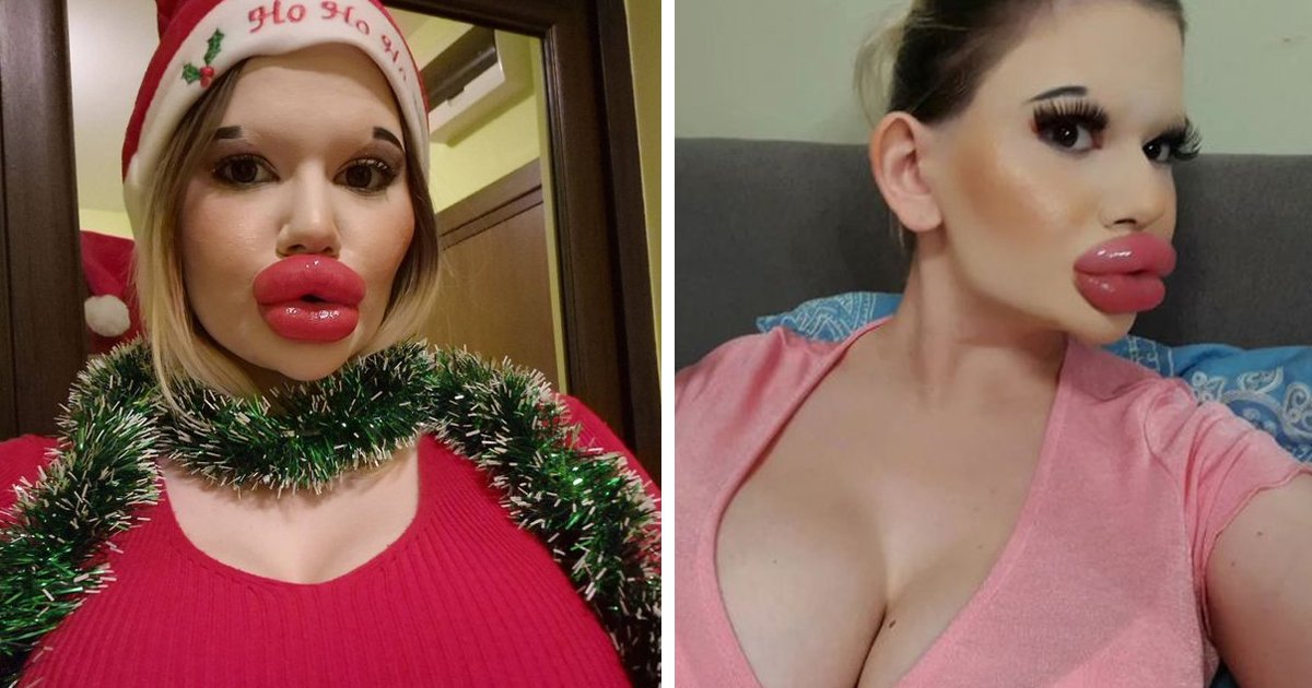 d166.jpg?resize=412,275 - EXCLUSIVE: Woman With MASSIVE Lips Offers The 'Highest Bidder' A Huge Mistletoe Kiss For Christmas