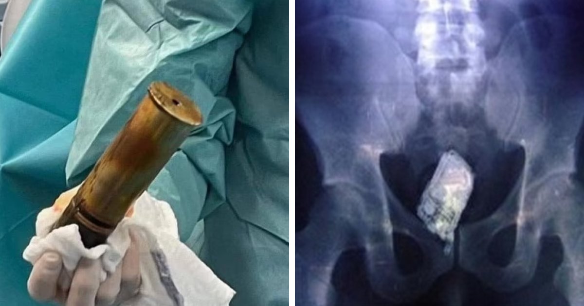 t6 7.png?resize=412,275 - BREAKING: Hospital EVACUATED As Man Enters With BOMB Stuck In His Bum
