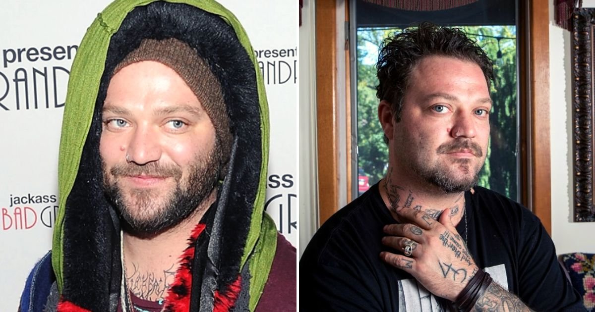 JUST IN: Bam Margera Was 'Pronounced DEAD' In Hospital After Suffering ...