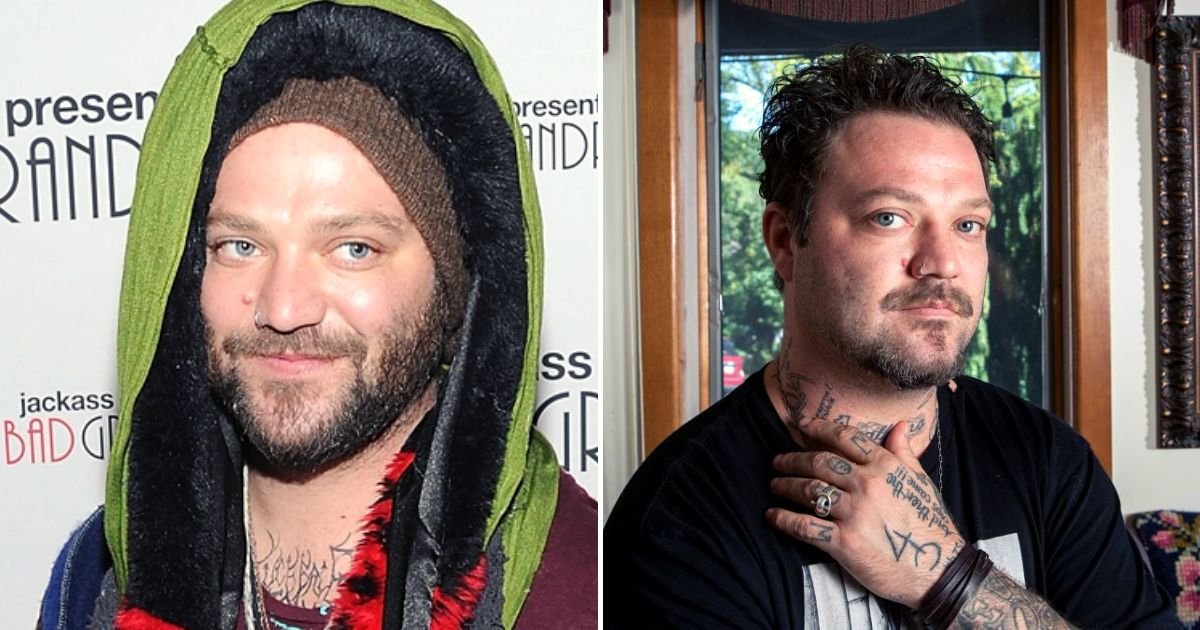 bam4.jpg?resize=1200,630 - JUST IN: Bam Margera Was 'Pronounced DEAD' In Hospital After Suffering Multiple Seizures And His Body Kept Shutting Down