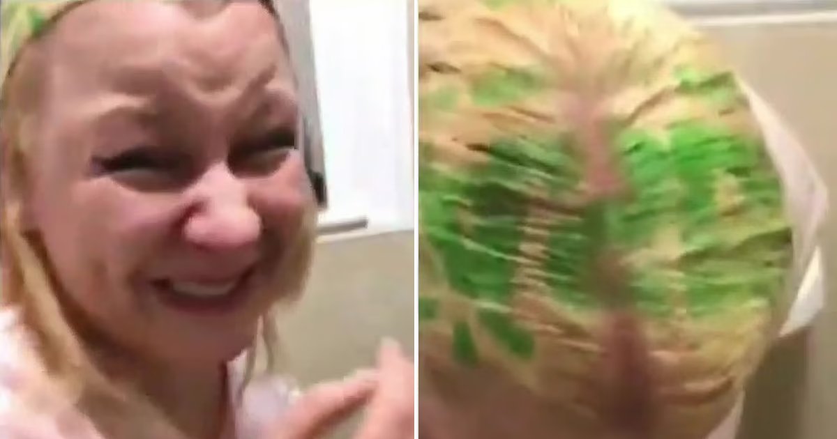 t3 5.png?resize=1200,630 - EXCLUSIVE: Mom MORTIFIED As She Ends Up With LOGO Printed Across Her Head After Using 'Store Bought Hair Dye'