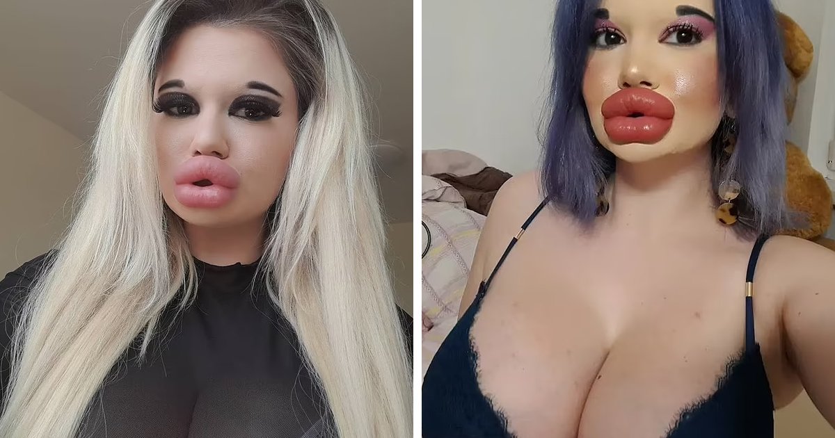 d123.jpg?fit=1024%2C538&ssl=1&strip=all - BREAKING: Woman With World's 'Biggest Lips' Is Now Investing Heavily In Her Cheekbones