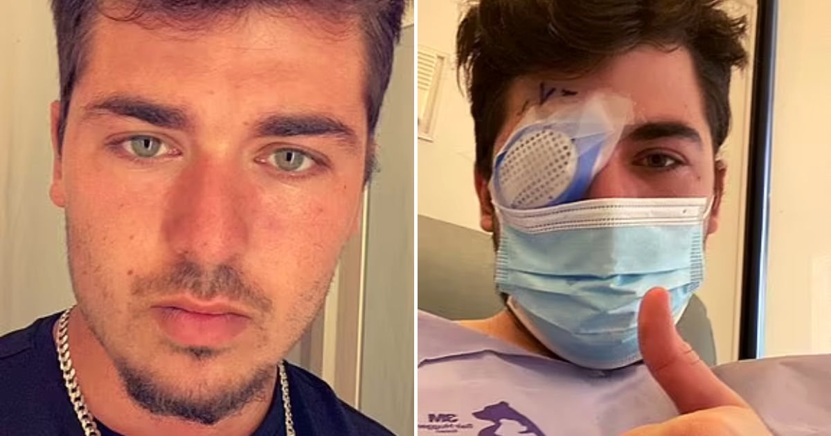eye4.jpg?fit=1024%2C538&ssl=1&strip=all - 21-Year-Old Man Lost An EYE After Taking A Quick Nap At His Part-Time Work As He Forgot To Remove His Contact Lenses