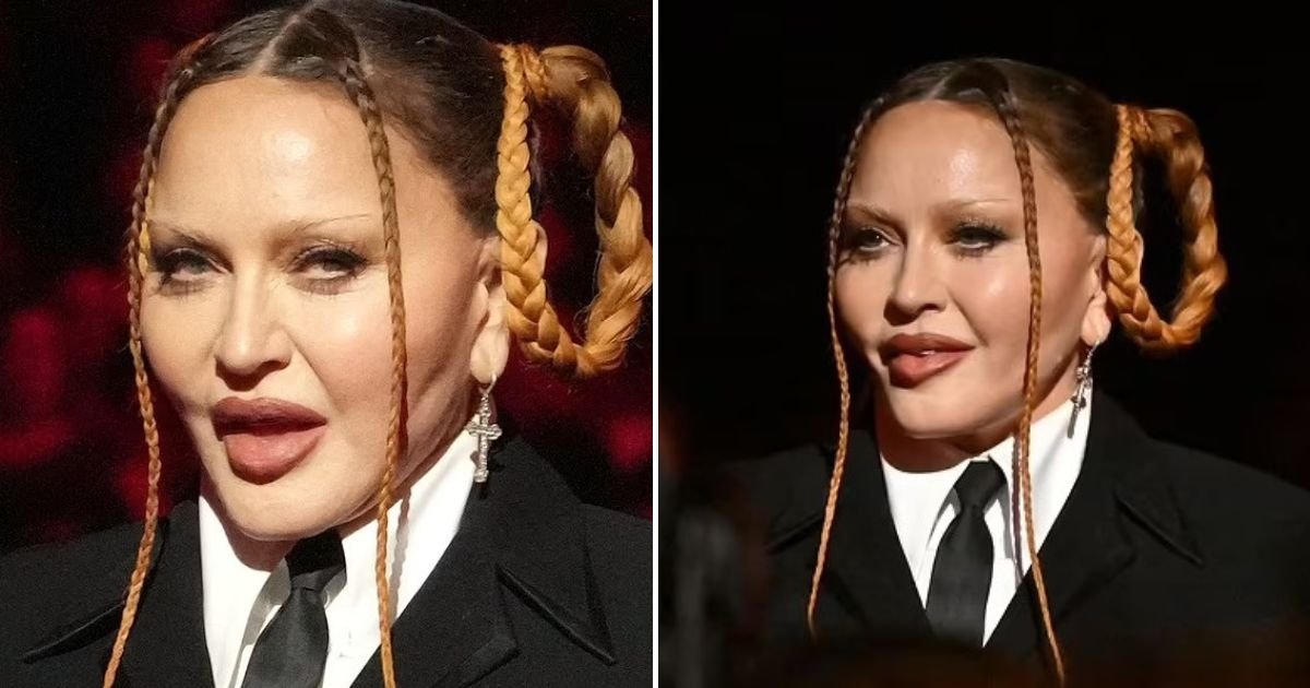 untitled design 2023 02 21t144338 062.jpg?resize=412,275 - Madonna Finally Admits She Underwent Plastic Surgery After Critics Branded Her UNRECOGNIZABLE