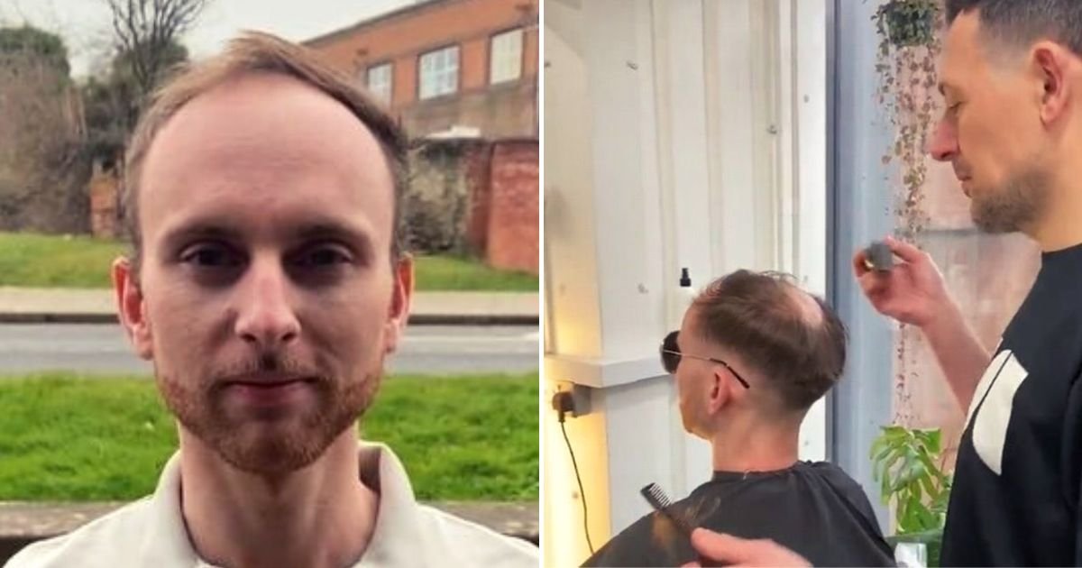hair4.jpg?resize=1200,630 - Balding Man BREAKS Down In Tears After Receiving A Realistic New Hair System That Made Him Look 20 YEARS Younger