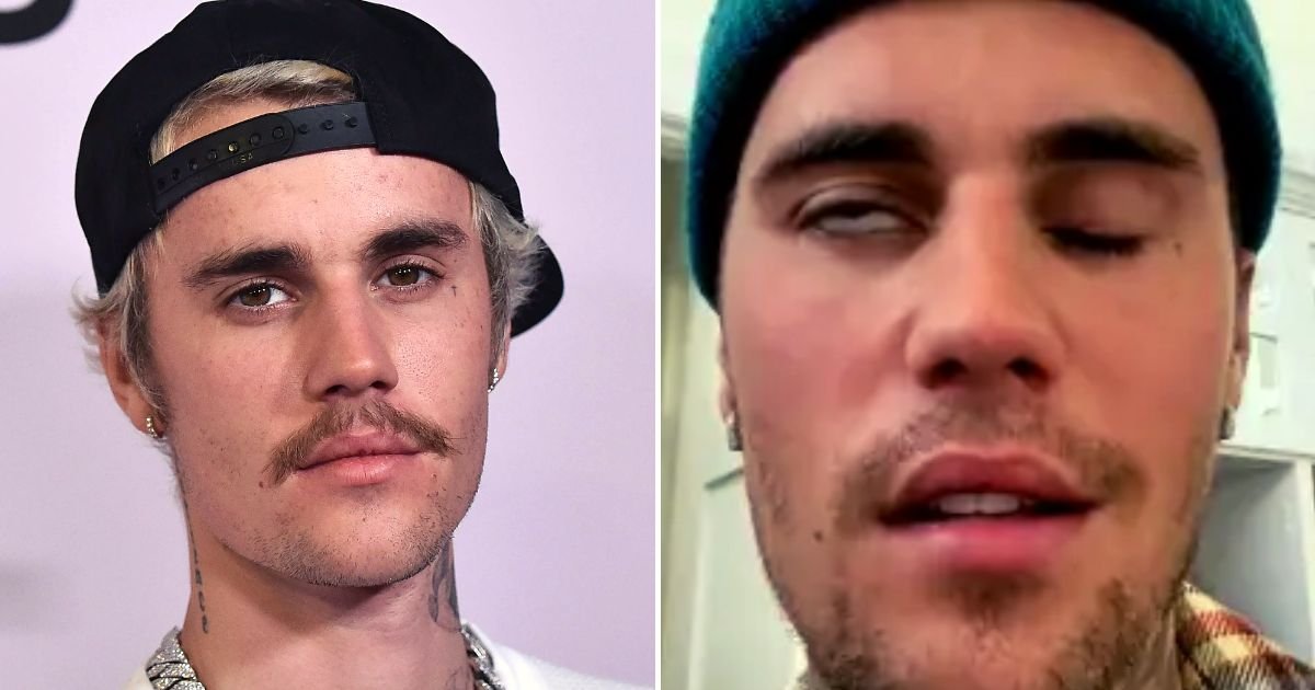 justin4.jpg?resize=412,275 - Justin Bieber, 29, Gives Health Update On Face Mobility After Being Diagnosed With Ramsey Hunt Syndrome