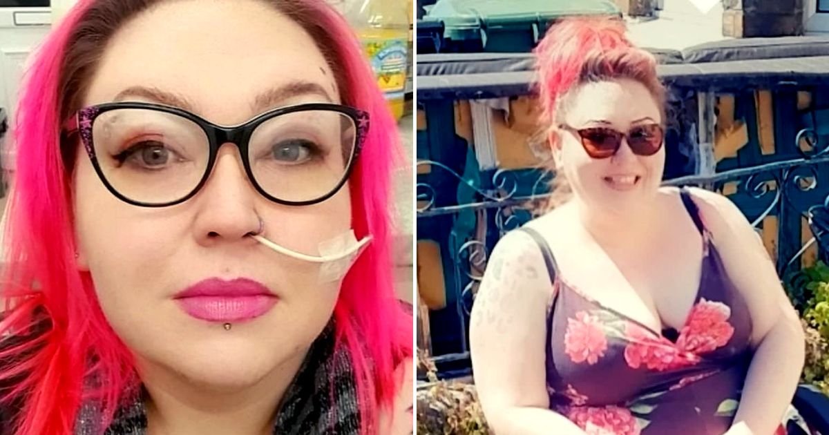 pinky4.jpg?fit=1024%2C538&ssl=1&strip=all - 45-Year-Old Woman's Organs Turn To CONCRETE After A Horror Gastric Sleeve Surgery To Reduce The Size Of Her Stomach