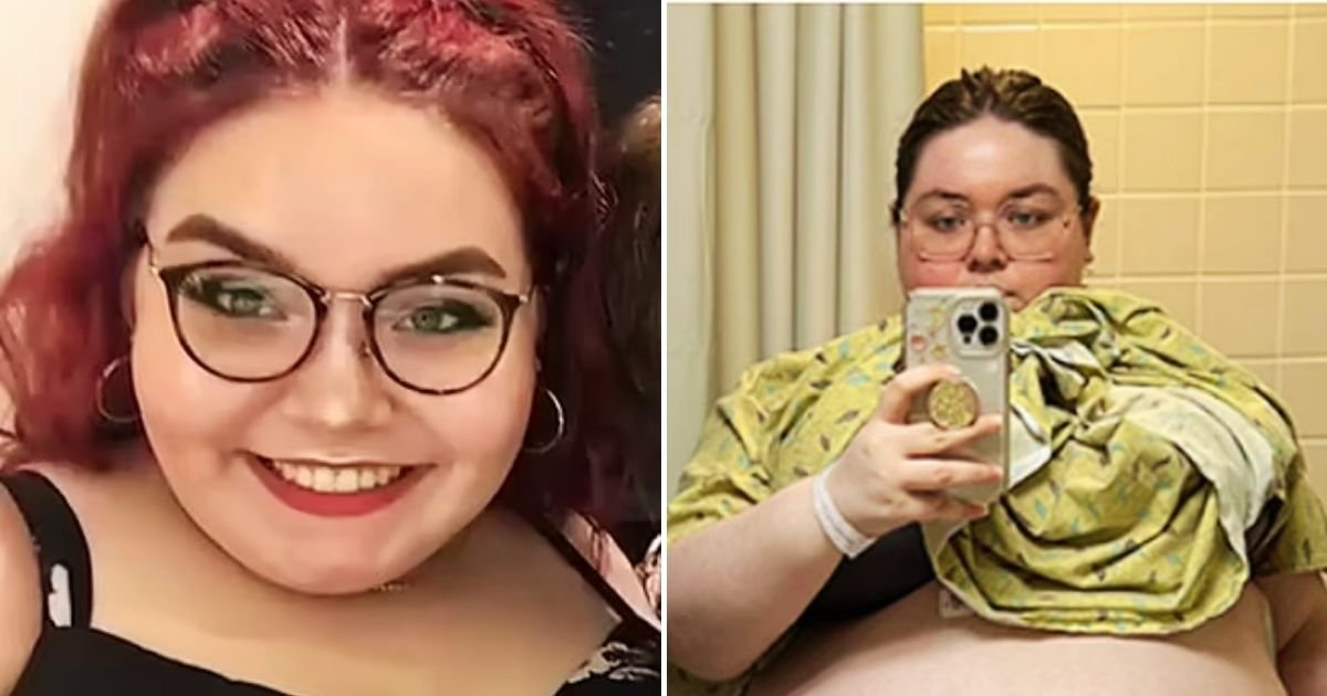 tumor4.jpg?fit=1024%2C538&ssl=1&strip=all - 20-Year-Old Woman Develops 100lb Tumor As Big As An EXERCISE Ball and Says She Feels Like 'Being Pregnant With 10 Kids'