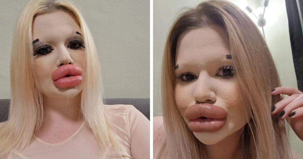 d52.jpg?resize=412,275 - EXCLUSIVE: Woman With World's Biggest Lips Says She Cannot Find Love Despite MILLIONS Of Fans