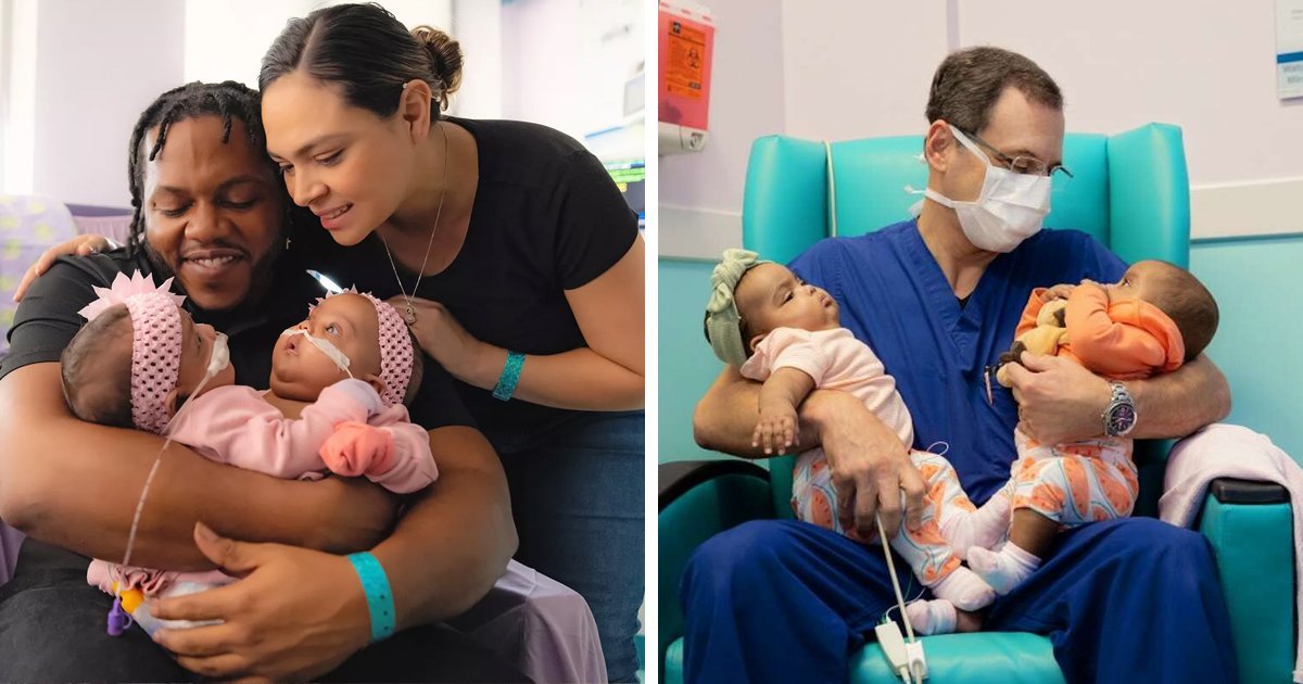d91.jpg?resize=412,275 - BREAKING: Formerly Conjoined Twins Are Home After MIRACULOUS Life-Saving Surgery