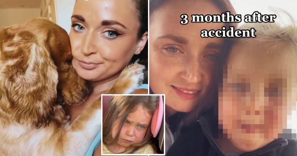 dog4.jpg?fit=1024%2C538&ssl=1&strip=all - Mother Faces Backlash After She Decided To Keep Her Dog That Attacked Her 3-Year-Old Daughter's Face And Left Her With Scars