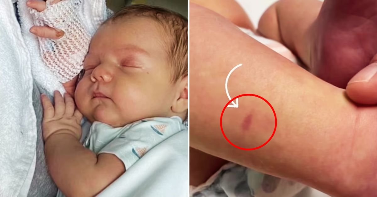 rash4.jpg?resize=1200,630 - Mother's Urgent WARNING After Baby's 'Innocent' Mark Turned Out To Be A Sign Of Life-Threatening Condition