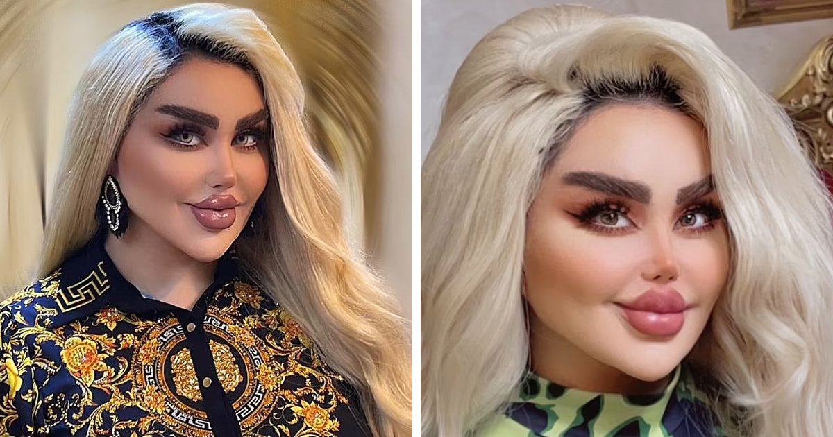 t2.jpg?resize=412,275 - EXCLUSIVE: Woman Undergoes 43 Cosmetic Procedures To Turn Into A Barbie Doll But Now Looks Like A ZOMBIE