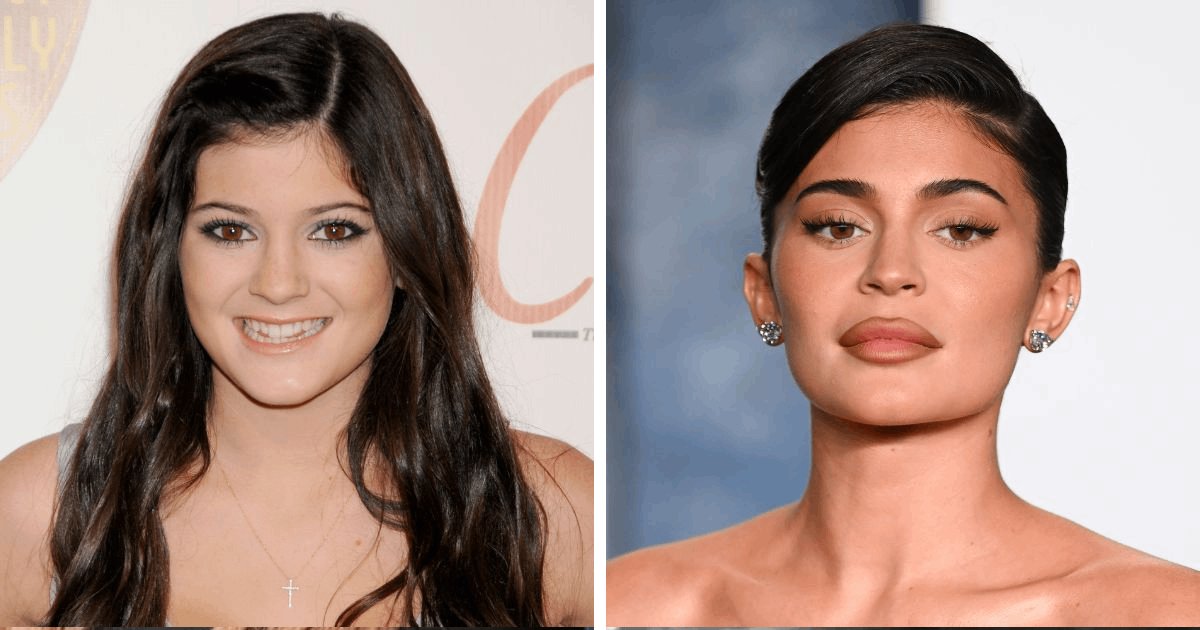 t5 20.png?resize=412,275 - "I Have Not Touched My Face, I'm Not Insecure"- Kylie Jenner Slammed For Shutting Down Claims About Plastic Surgery On Her Face
