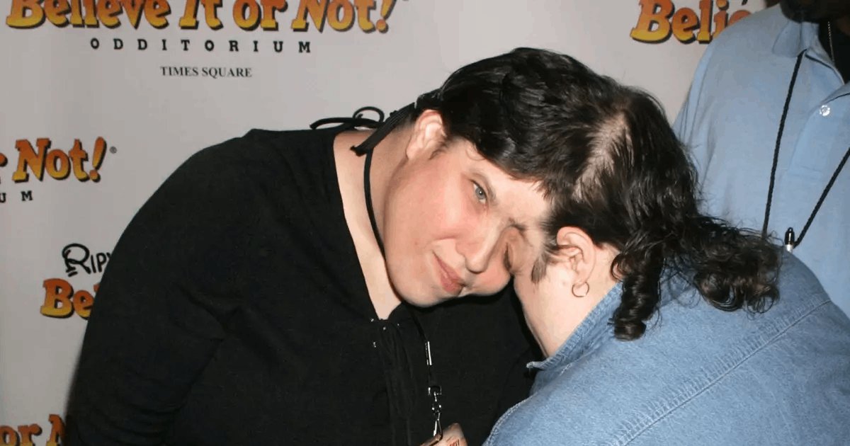 t5 43.png?resize=412,275 - Conjoined Twins Explain What Happens During Sister's Intimate Moments With Boyfriends