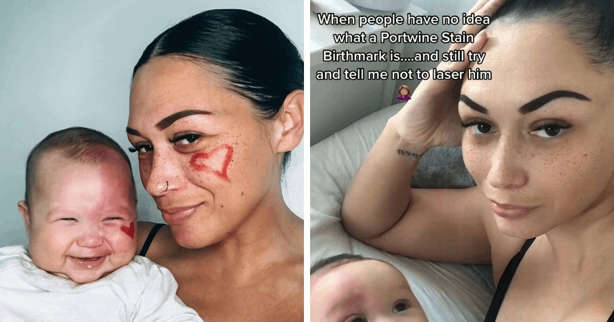 t5 45.png?resize=412,275 - EXCLUSIVE: Mom Bashed By Followers For Choosing To Remove Her Baby's Birthmark With LASER
