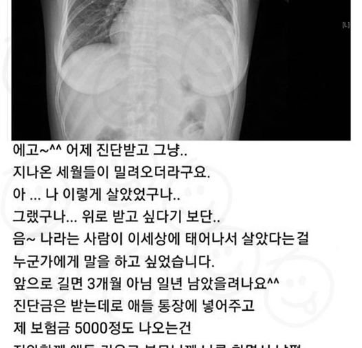 2 14.jpg?resize=412,232 - 폐암 말기 판정 받고 기뻐하는 여자