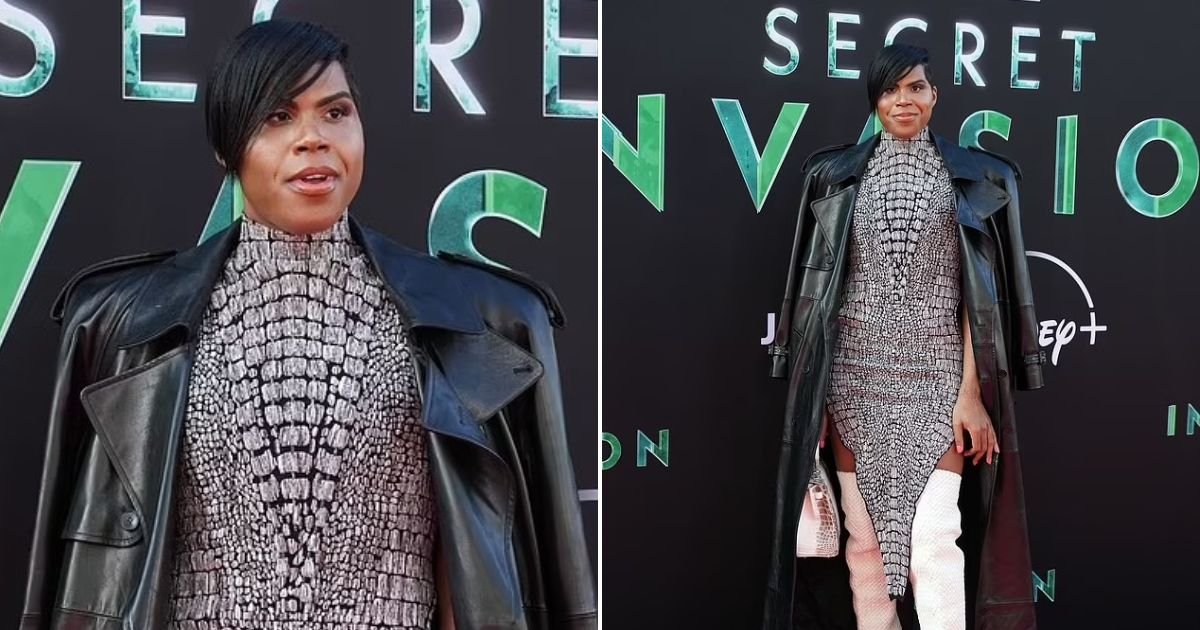 untitled design 93.jpg?resize=412,275 - Magic Johnson’s Son Dazzles In High Heels And Sparkling Dress After Dramatic Weight Loss