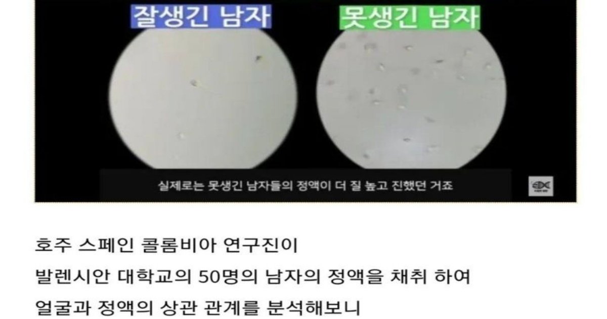 366349442 305162128691625 2273334164900611985 n.jpeg?resize=1200,630 - 잘생긴 남자들에게 치명적인 문제발견 됨