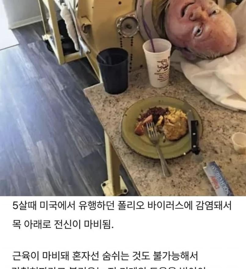 4 12.jpg?resize=1200,630 - 소아마비로 전신이 마비돼서 70년간 기계안에서 살아온 남자