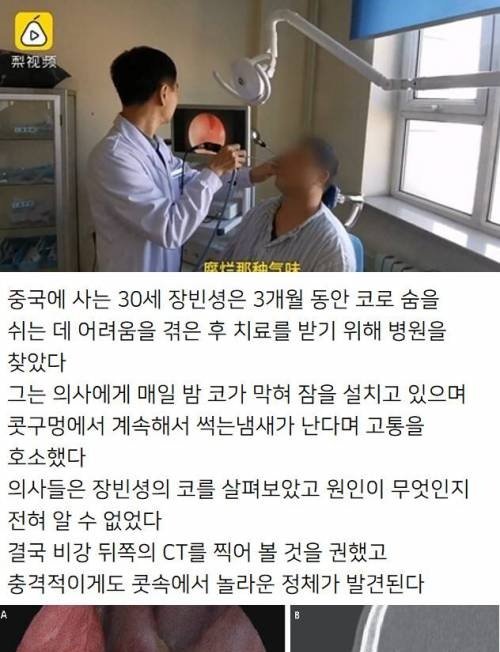 4 5.jpg?resize=412,232 - 코에서 썩은내가 나던 이유...;;