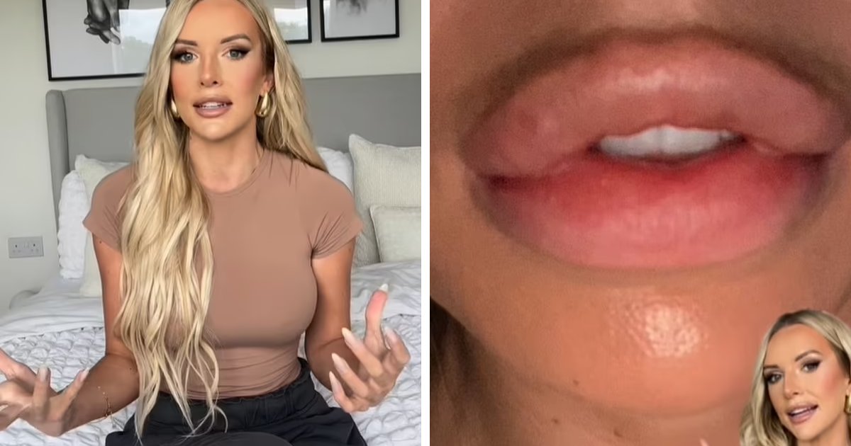 m8.png?resize=1200,630 - "Yes I RUINED My Face!"- Faye Winter Admits She Went 'Too Far' With Her Lip Fillers' And Is Now Seeking Help After The Disaster