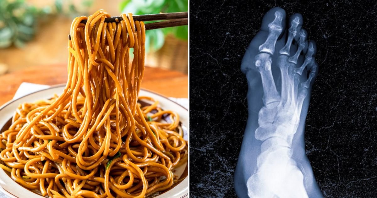 noodles.jpg?resize=412,275 - Man Loses FINGERS And Both Of His LEGS After Eating Noodles