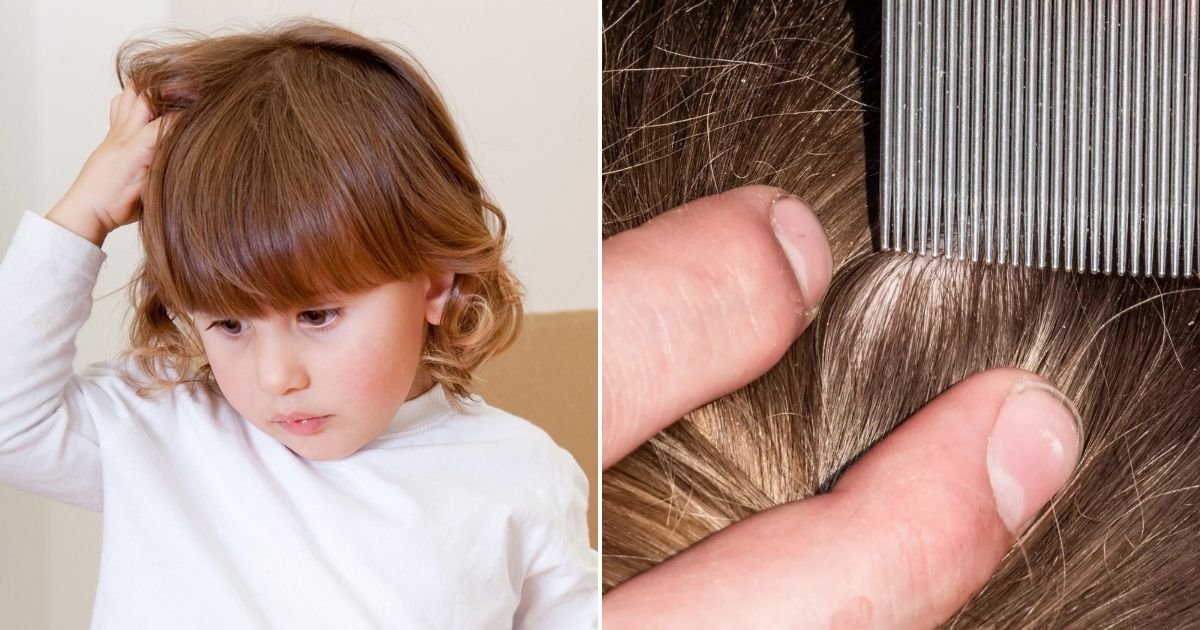 untitled design 59.jpg?resize=412,275 - Vegan Mom Refuses To Treat Daughter's Lice Infestation Because She Doesn't Want To Hurt The Blood-Sucking Insects