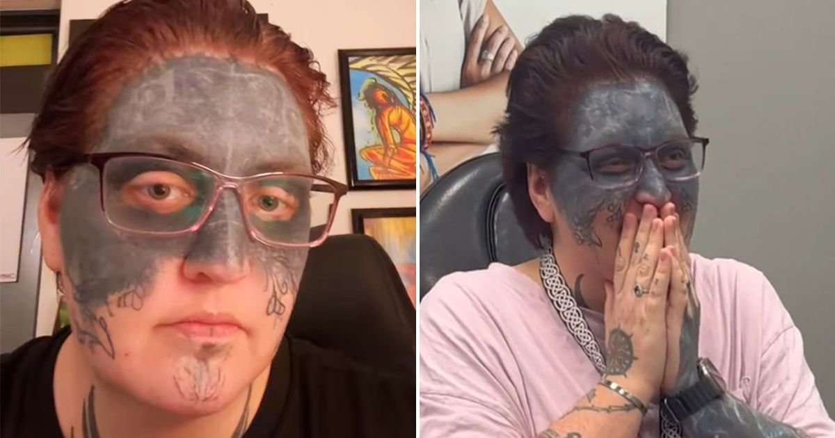 white4.jpg?fit=1024%2C538&ssl=1&strip=all - Florida Woman Whose Face Was Tattooed Against Her Will Finally Get Ink Removed After She Shared Her Heartbreaking Story