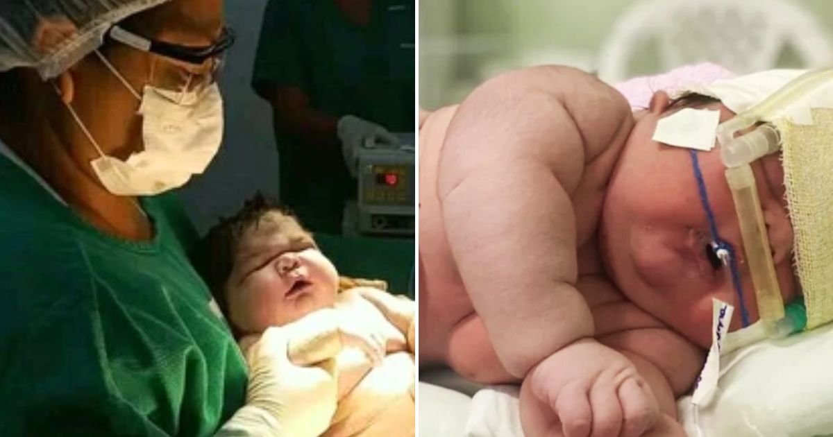 angerson4.jpg?resize=1200,630 - Woman Leaves Doctors Stunned After Giving Birth To GIANT 2ft Tall Baby Via C-Section